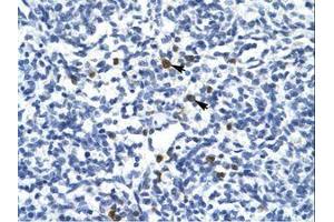 Image no. 1 for anti-T-Cell Acute Lymphocytic Leukemia 1 (TAL1) (AA 236-285) antibody (ABIN6735910) (TAL1 抗体  (AA 236-285))