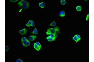 Immunofluorescent analysis of MCF-7 cells using ABIN7166350 at dilution of 1:100 and Alexa Fluor 488-congugated AffiniPure Goat Anti-Rabbit IgG(H+L) (YIPF6 抗体  (AA 2-84))