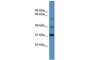 WB Suggested Anti-SOX1 Antibody Titration: 1. (SOX1 抗体  (C-Term))