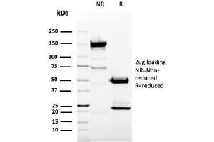 SDS-PAGE Analysis Purified CD11b Mouse Monoclonal Antibody (ITGAM/3337). (CD11b 抗体  (AA 941-1074))
