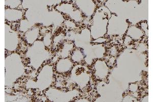 ABIN6263216 and ABIN6269229 at 1/100 staining Rat lung tissue by IHC-P.