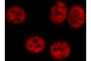 ABIN6267348 staining HeLa cells by IF/ICC. (MYB 抗体  (pSer532))