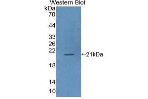 Western blot analysis of the recombinant protein. (ICAM-3/CD50 抗体  (AA 46-197))