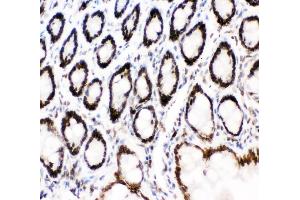 IHC analysis of MAD1 using anti-MAD1 antibody (ABIN3043387).