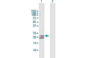 Western Blot analysis of CEACAM21 expression in transfected 293T cell line by CEACAM21 MaxPab polyclonal antibody. (CEACAM21 抗体  (AA 1-191))