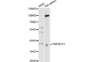Western blot analysis of extracts of various cell lines, using TMEM173 antibody (ABIN5999064) at 1/1000 dilution. (STING/TMEM173 抗体)