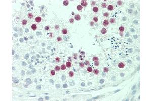 Anti-SYCE2 antibody IHC staining of human testis. (SYCE2 抗体  (AA 1-30))