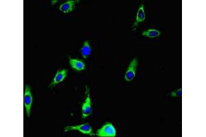 Immunofluorescent analysis of Hela cells using ABIN7144308 at dilution of 1:100 and Alexa Fluor 488-congugated AffiniPure Goat Anti-Rabbit IgG(H+L) (Anoctamin 4 抗体  (AA 1-200))