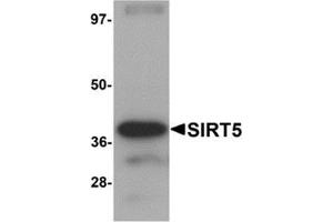 Western blot analysis of SIRT5 in human liver tissue lysate with SIRT5 antibody at 1 μg/ml. (SIRT5 抗体  (C-Term))