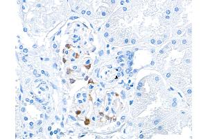 Immunohistochemistry (IHC) image for anti-Tight Junction Protein 1 (TJP1) (AA 650-700) antibody (ABIN7453989) (Recombinant TJP1 抗体  (AA 650-700))