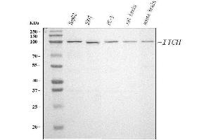Western blot analysis of ITCH/AIP4 using anti-ITCH/AIP4 antibody (ABIN7600263).