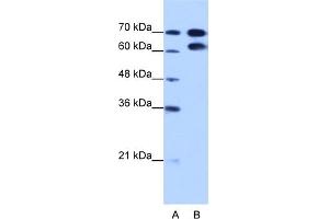 WB Suggested Anti-RAVER1 Antibody Titration:  1. (RAVER1 抗体  (N-Term))
