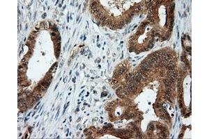 Immunohistochemical staining of paraffin-embedded Kidney tissue using anti-LIPG mouse monoclonal antibody. (LIPG 抗体)