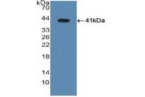 Detection of Recombinant LXRa, Human using Polyclonal Antibody to Liver X Receptor Alpha (LXRa) (NR1H3 抗体  (AA 95-434))