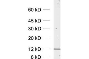 dilution: 1 : 1000, sample: HELA cell lysate (VAMP8 抗体  (Cytoplasmic Domain))