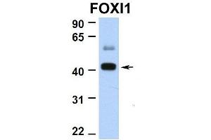 Hum. (FOXI1 抗体  (N-Term))