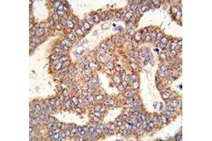 Immunohistochemistry (IHC) image for anti-Transient Receptor Potential Cation Channel, Subfamily M, Member 8 (TRPM8) (AA 1075-1104) antibody (ABIN3029243)