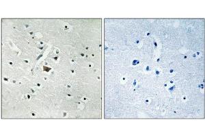 Immunohistochemical analysis of paraffin-embedded human brain tissue using PLD2 (Phospho-Tyr169) antibody (left)or the same antibody preincubated with blocking peptide (right). (Phospholipase D2 抗体  (pTyr169))