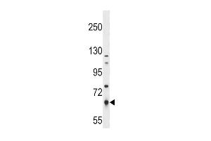 PKLR Antibody (S8) (ABIN391050 and ABIN2841209) western blot analysis in NCI- cell line lysates (35 μg/lane). (PKLR 抗体  (N-Term))