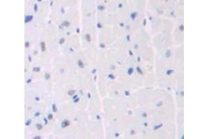 Used in DAB staining on fromalin fixed paraffin- embedded heart tissue (ANKRD1 抗体  (AA 1-319))