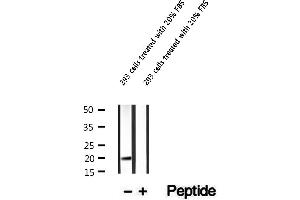 Western blot analysis of extracts of 293 cells treated with 20% FBS , using Phospho-4EBP1(Ser65/Thr70) Antibody.