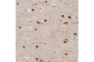 Immunohistochemical staining of human cerebral cortex with BAIAP2L2 polyclonal antibody  shows strong nuclear and cytoplasmic positivity in neuronal cells at 1:50-1:200 dilution. (BAIAP2L2 抗体)