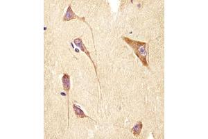 (ABIN6244245 and ABIN6578502) staining GNG2 in human brain tissue sections by Immunohistochemistry (IHC-P - paraformaldehyde-fixed, paraffin-embedded sections). (GNG2 抗体  (AA 19-52))