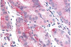 Human Stomach: Formalin-Fixed, Paraffin-Embedded (FFPE) (TMEM33 抗体  (Internal Region))
