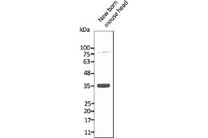 Western Blotting (WB) image for anti-Neuropeptide Y Receptor Y2 (NPY2R) (C-Term) antibody (ABIN7273070) (NPY2R 抗体  (C-Term))