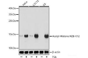 Western blot analysis of extracts of various cell lines using Acetyl-Histone H2B-K12 Polyclonal Antibody at dilution of 1:1000. (Histone H2B 抗体  (acLys12))