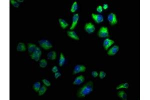 Immunofluorescence staining of Hela cells with ABIN7142963 at 1:100, counter-stained with DAPI. (CHRND 抗体  (AA 334-471))