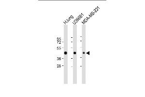All lanes : Anti-HLA-F Antibody (Center) at 1:2000 dilution Lane 1: Human lung lysate Lane 2: U266B1 whole cell lysate Lane 3: MDA-MB-231 whole cell lysate Lysates/proteins at 20 μg per lane. (HLA-F 抗体  (AA 172-198))