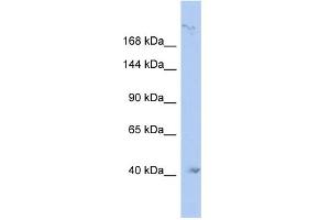 WB Suggested Anti-KIF1A Antibody Titration:  0. (KIF1A 抗体  (N-Term))