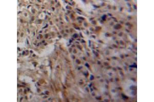 Used in DAB staining on fromalin fixed paraffin-embedded ovary tissue (TGM3 抗体  (AA 468-693))
