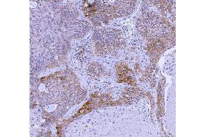 IHC analysis of WDR44 using anti-WDR44 antibody (ABIN7600394). (WDR44 抗体  (AA 188-913))