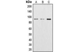Western blot analysis of Beta-catenin expression in Jurkat (A), Raw264. (beta Catenin 抗体  (N-Term))