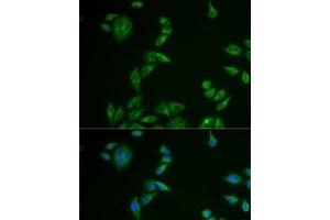 Immunofluorescence analysis of U2OS cells using MLANA Polyclonal Antibody (MLANA 抗体)