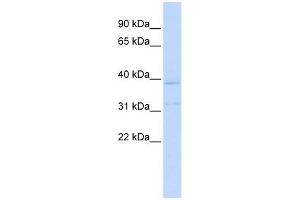 KCNK15 antibody used at 1 ug/ml to detect target protein. (KCNK15 抗体  (Middle Region))