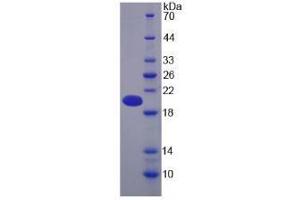 SDS-PAGE analysis of Human Pregnancy Zone Protein. (PZP 蛋白)