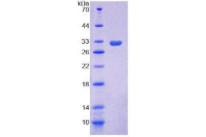 SDS-PAGE analysis of Human ASK1 Protein. (ASK1 蛋白)