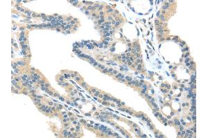 Immunohistochemistry (IHC) image for anti-Vacuolar Protein Sorting 36 (VPS36) antibody (ABIN5959966) (VPS36 抗体)