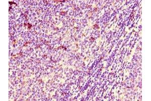 Immunohistochemistry of paraffin-embedded human lymph node tissue using ABIN7150983 at dilution of 1:100 (ARIH2 抗体  (AA 43-360))