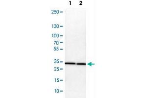Western Blot analysis of Lane 1: NIH-3T3 cell lysate (mouse embryonic fibroblast cells) and Lane 2: NBT-II cell lysate (Wistar rat bladder tumor cells) with ARPC2 polyclonal antibody . (ARPC2 抗体)