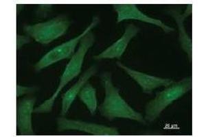 Immunostaining analysis in HeLa cells. (CTCF 抗体)