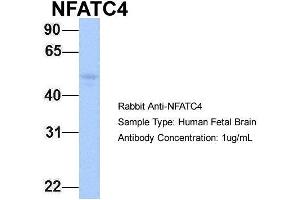 Host:  Rabbit  Target Name:  NFATC4  Sample Type:  Human Fetal Brain  Antibody Dilution:  1. (NFATC4 抗体  (N-Term))