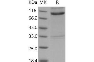 RTN4R Protein (His tag,Fc Tag)