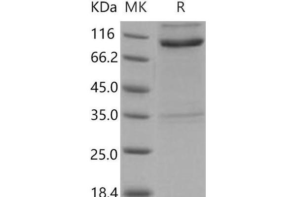 RTN4R Protein (His tag,Fc Tag)