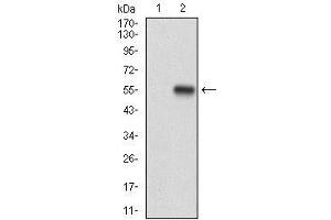 Western blot analysis using CD10 mAb against HEK293 (1) and CD10 (AA: 52-246)-hIgGFc transfected HEK293 (2) cell lysate. (MME 抗体  (AA 52-246))