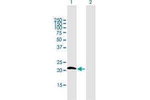 Western Blot analysis of GPX7 expression in transfected 293T cell line by GPX7 MaxPab polyclonal antibody. (Glutathione Peroxidase 7 抗体  (AA 1-187))
