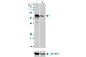 Western blot analysis of RBM5 over-expressed 293 cell line, cotransfected with RBM5 Validated Chimera RNAi (Lane 2) or non-transfected control (Lane 1). (RBM5 抗体  (AA 75-184))